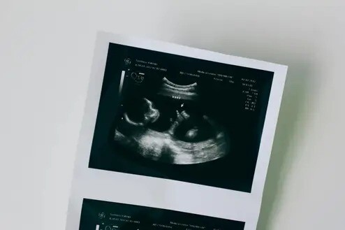 Fetal-Medicine-in-Indore.jpeg