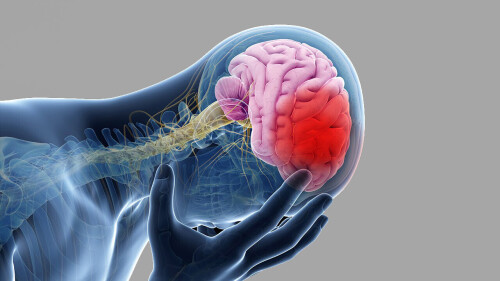 Stroke-12.jpg