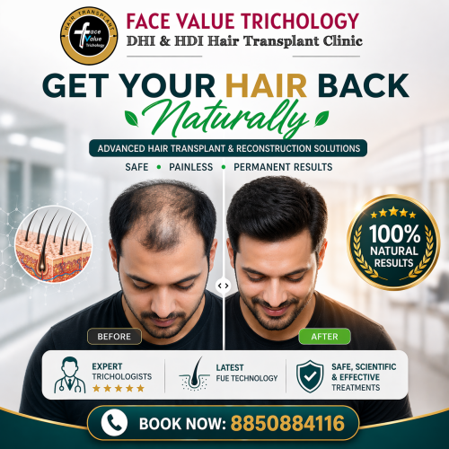 Get-Your-Hair-Back-Naturally-Advanced-Hair-Transplant-in-Chennai.png