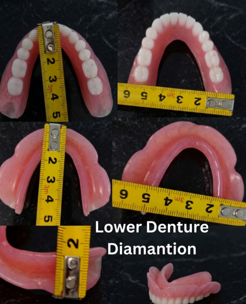 Lower-denture-diamention.png
