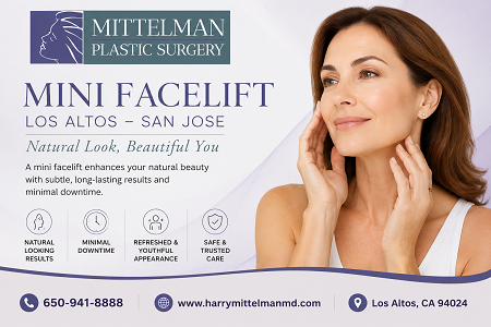 Mini-Facelift-in-Los-Altos.png