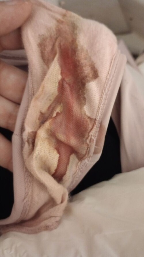 Staceys-bloody-panties.jpeg