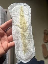 Staceys-used-panty-liner-2.jpeg