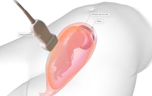 Amniocentesis-Test-in-Indore.jpeg
