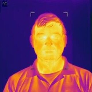 IR_Fever_Scan_Normal