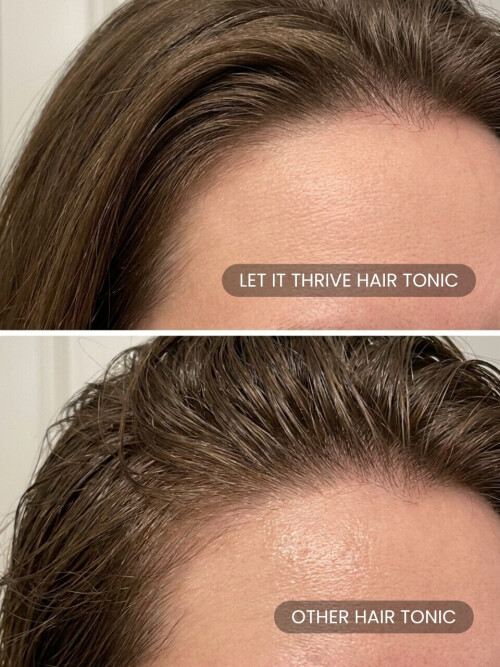 Let It Thrive Hair Tonic compared to other hair tonics