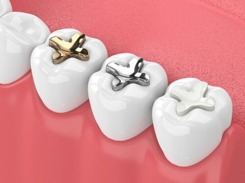Emergency-Dentistry-Silver-Spring.jpeg
