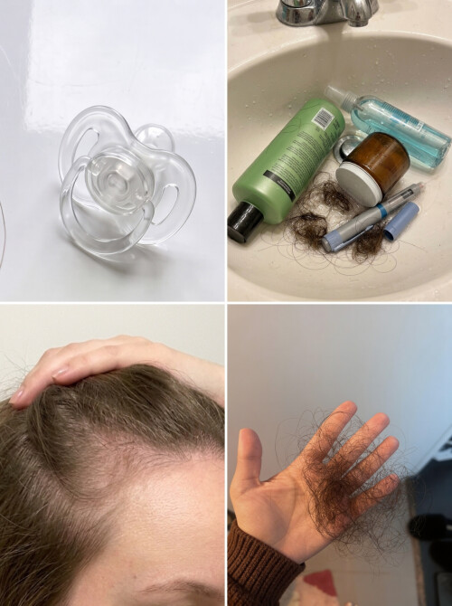 Illustration of the follicle recovery window